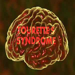 tourette-sendromu-2